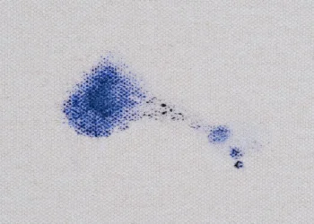 Sim, é possível eliminar riscos de caneta com laca. Respire fundo!